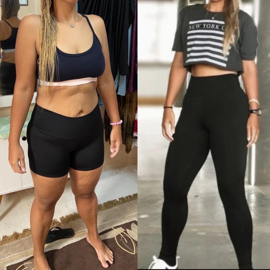 Antes e depois de aluna do Scalea Team — ganho de glúteos