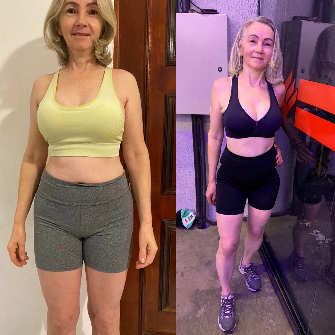 Antes e depois de aluna do Scalea Team — hipertrofia de membros inferiores